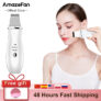 Esfoliante ultrassónico, limpeza de poros, limpeza facial e cuidado facial